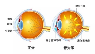 学科建设 | “浴血”奋战，保卫眼球