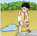专家课堂开课了︱春暖花开，别让运动太“受伤”